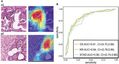 Computational Analysis of Pathological Image Enables Interpretable Prediction for Microsatellite Instability